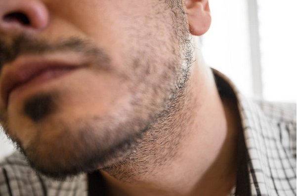 Como fazer a barba crescer?