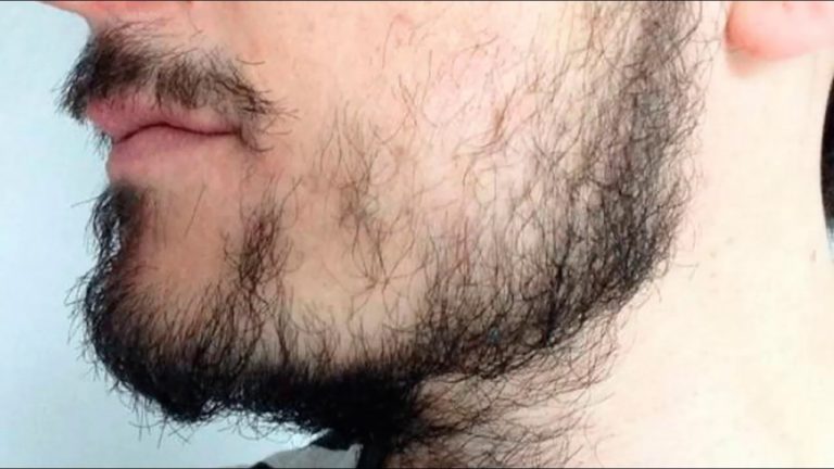 Cuidados com a barba falhada